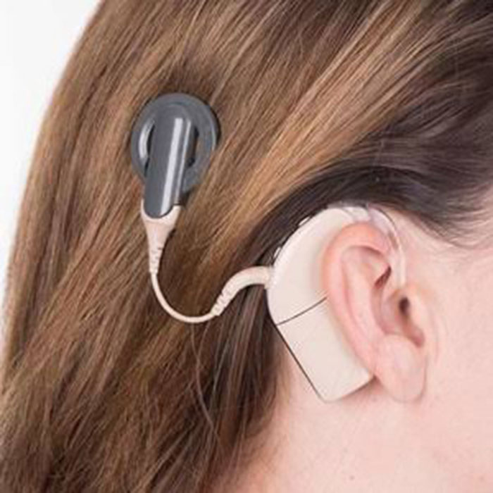 Cochlear Implants surgery in Pune 